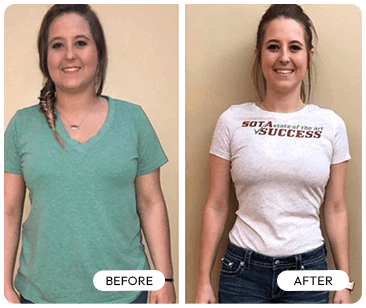 Trimology weight loss before and after — Marry M real women results