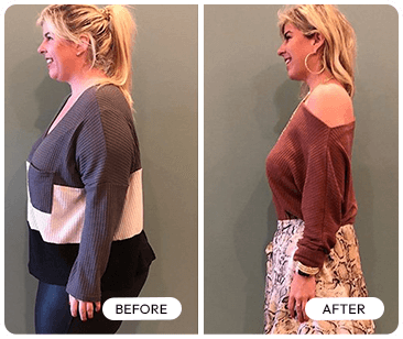 Trimology weight loss before and after — Olivia J real women results