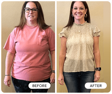 Trimology weight loss before and after — Peggy S real women results